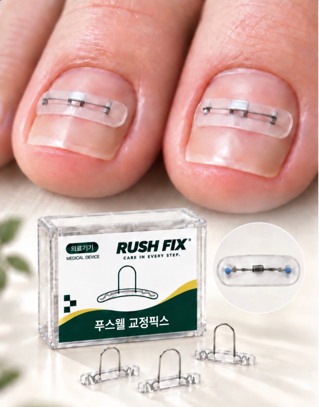 푸스웰 교정픽스 1·2 와이어 타입 제품과 착용 디테일